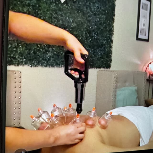 Cupping 60 mins Save $50 at Valencia Muscular Therapy in San Antonio, TX